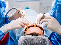 Digital illustration showing a sinus lift in Wellesley for dental implant