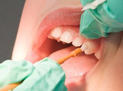 Patient receiving fluoride treatment