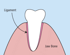Animated tooth during extraction
