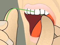 Animated smile with floss between teeth