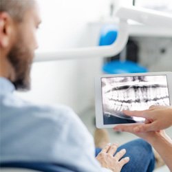 Dentist explaining gum disease to patient while pointing at X-ray