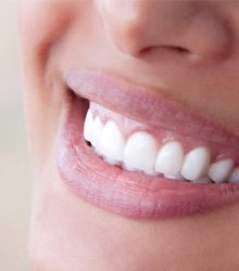 Closeup of a healthy, beautiful smile thanks to Wellesley Dental Group