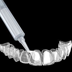 Illustration of whitening gel being placed in custom tooth tray